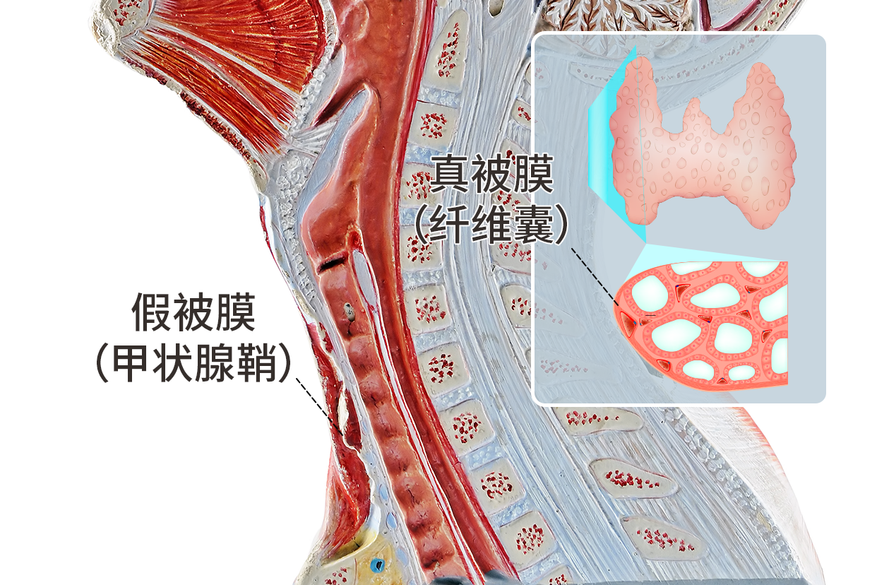 甲状腺被膜图