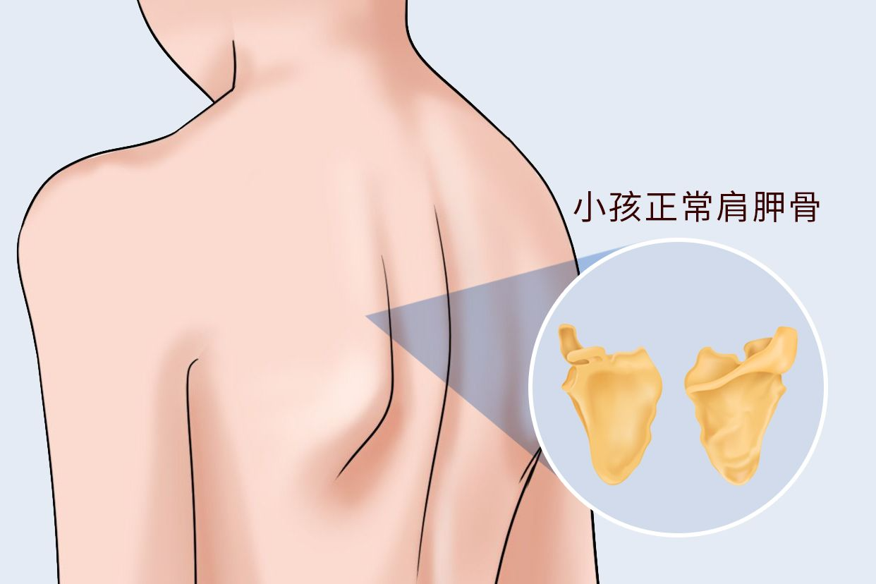 小孩正常肩胛骨图片