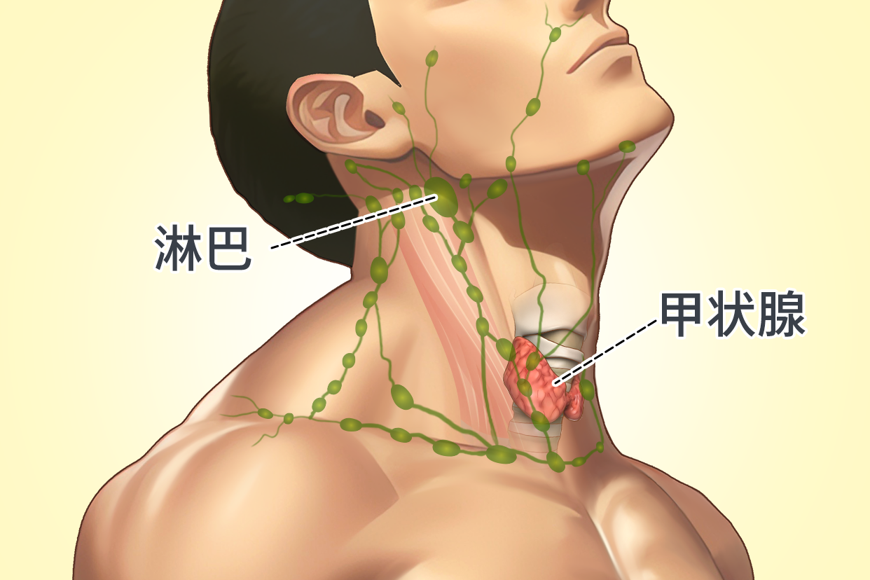 甲状腺和淋巴图片