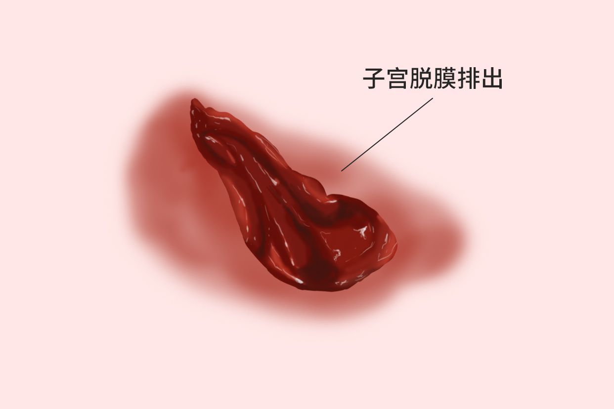 二次元 子宫  脱出 