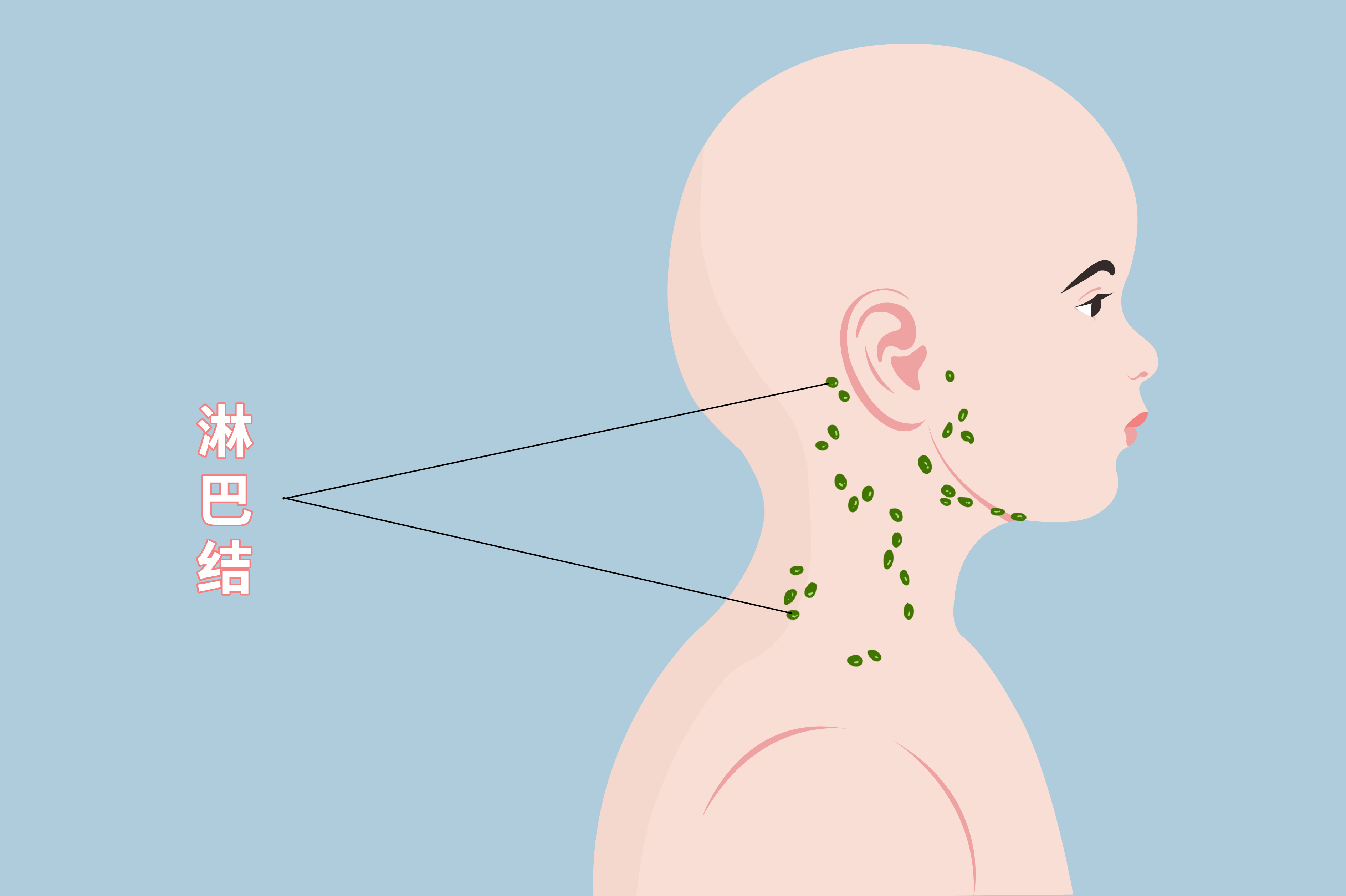 孩子脖子淋巴结图片图片