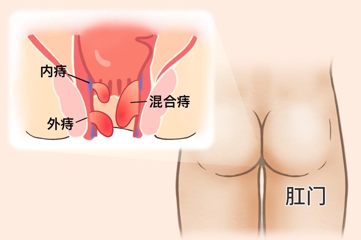 直肠图片