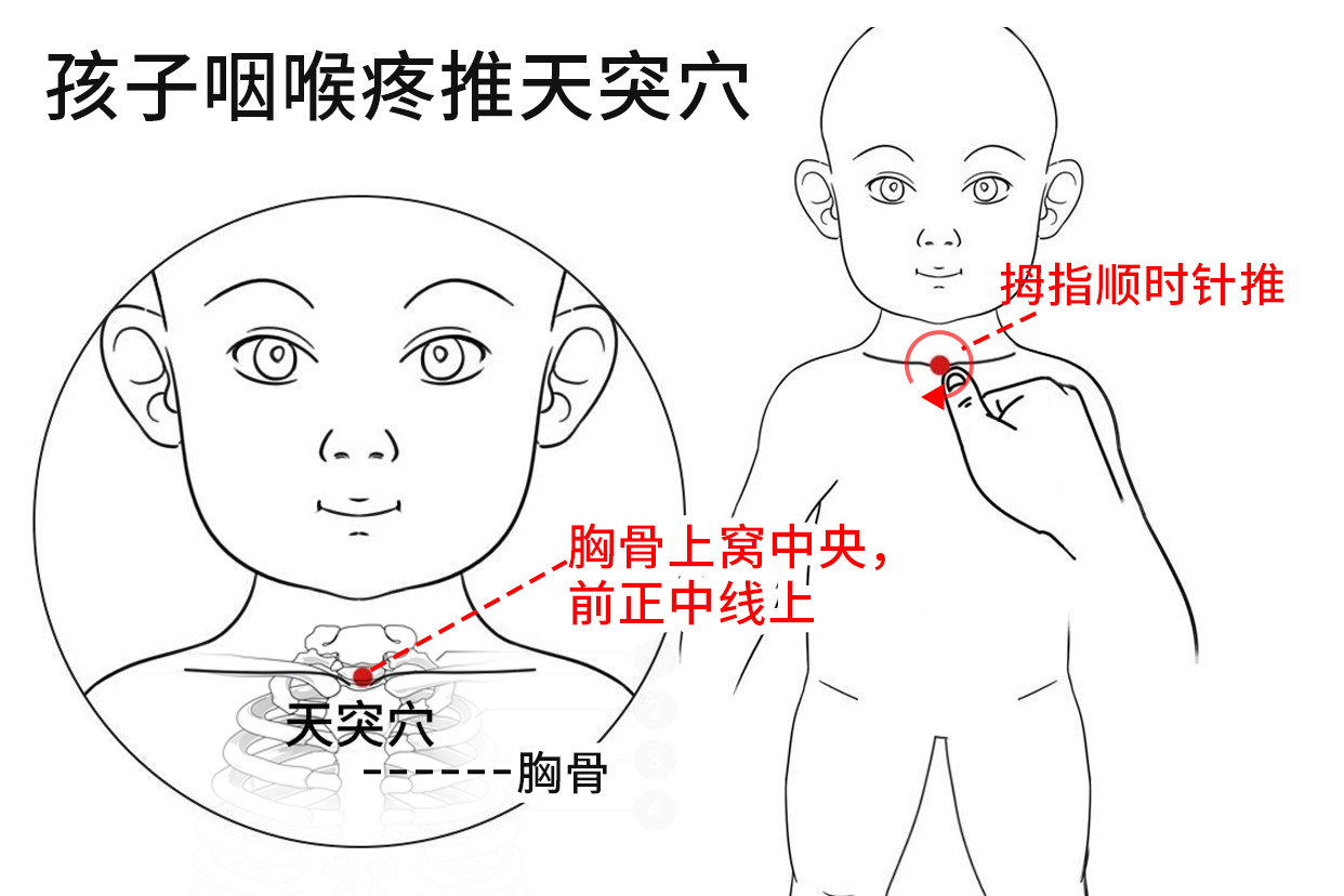 孩子咽喉疼推天突穴图
