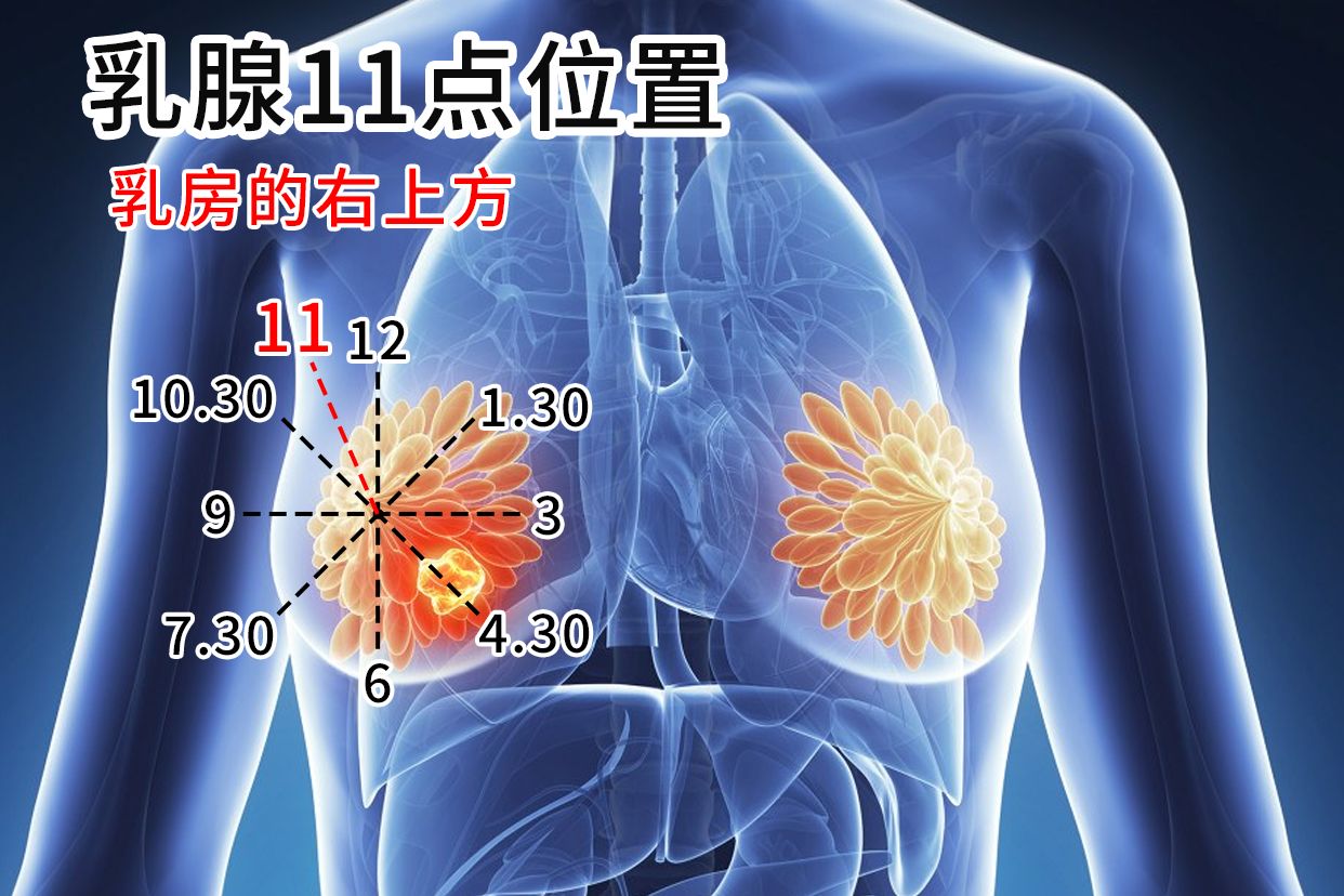 右乳11点方向位置图图片