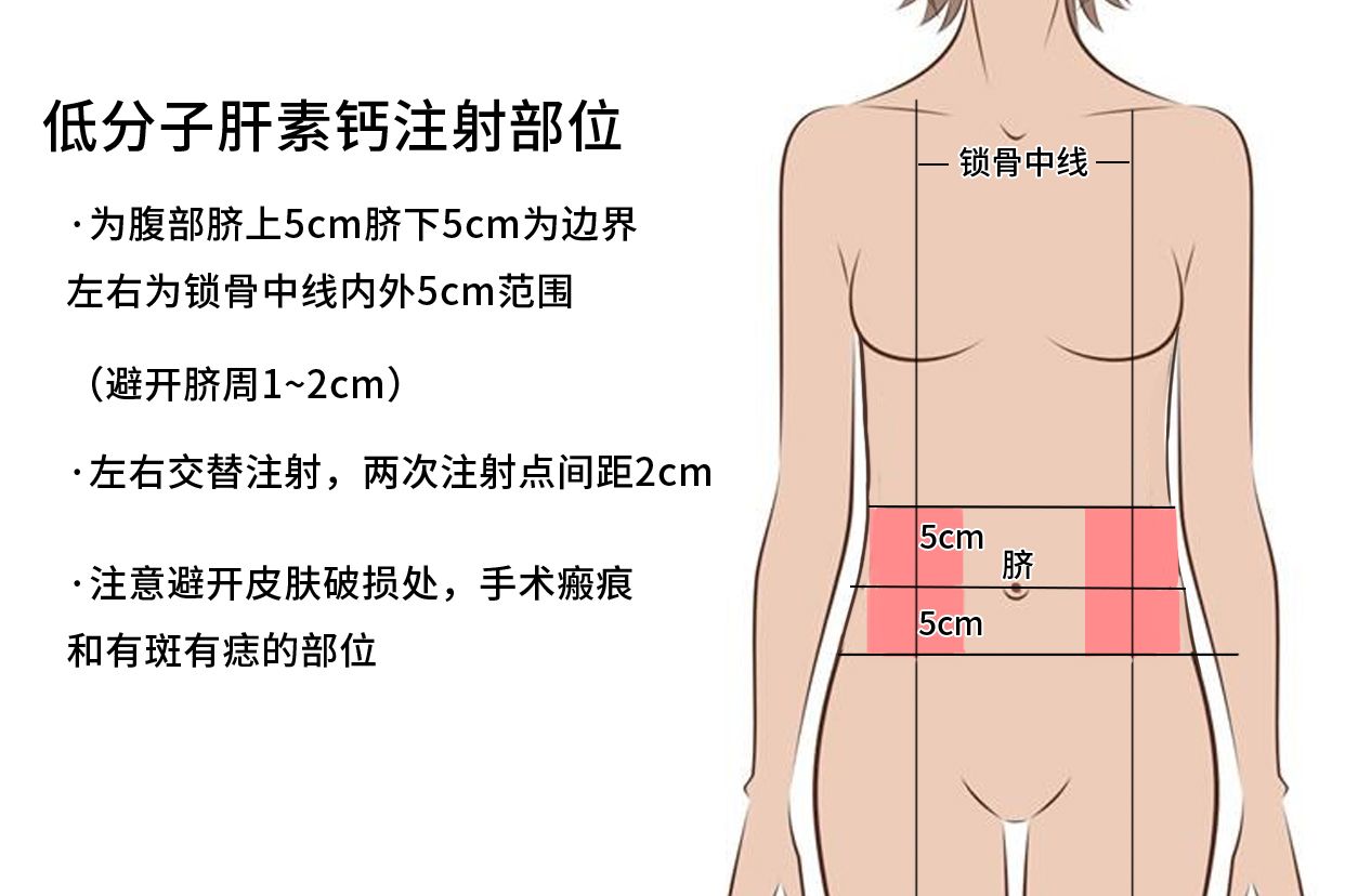 低分子肝素钙注射部位图片