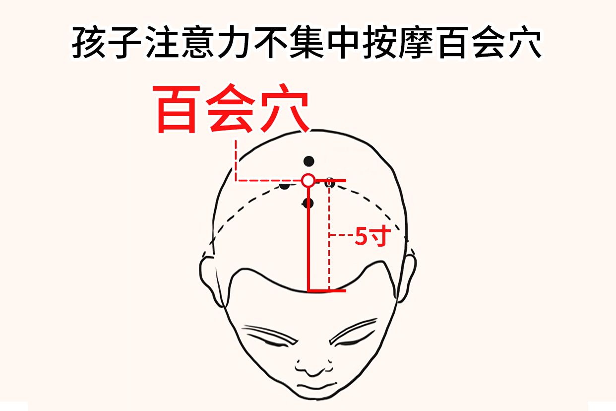 孩子注意力不集中按摩百会穴图